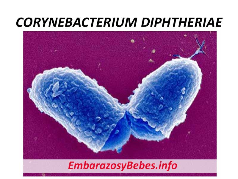 Corynebacterium diphtheria