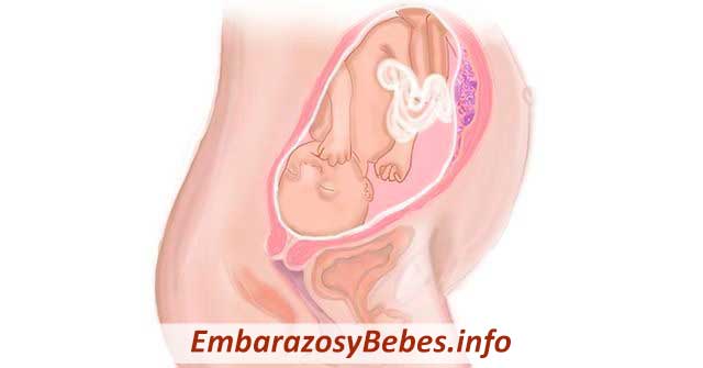 Semana 29 de Embarazo
